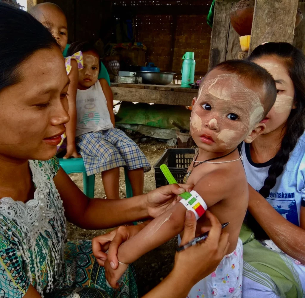 Medical Action Myanmar kindje wordt geholpen.